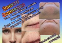 Электроэпиляция, удаление волос навсегда... оголошення Bazarok.ua